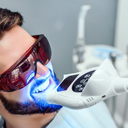 Teeth-Whitening Teeth-Whitening